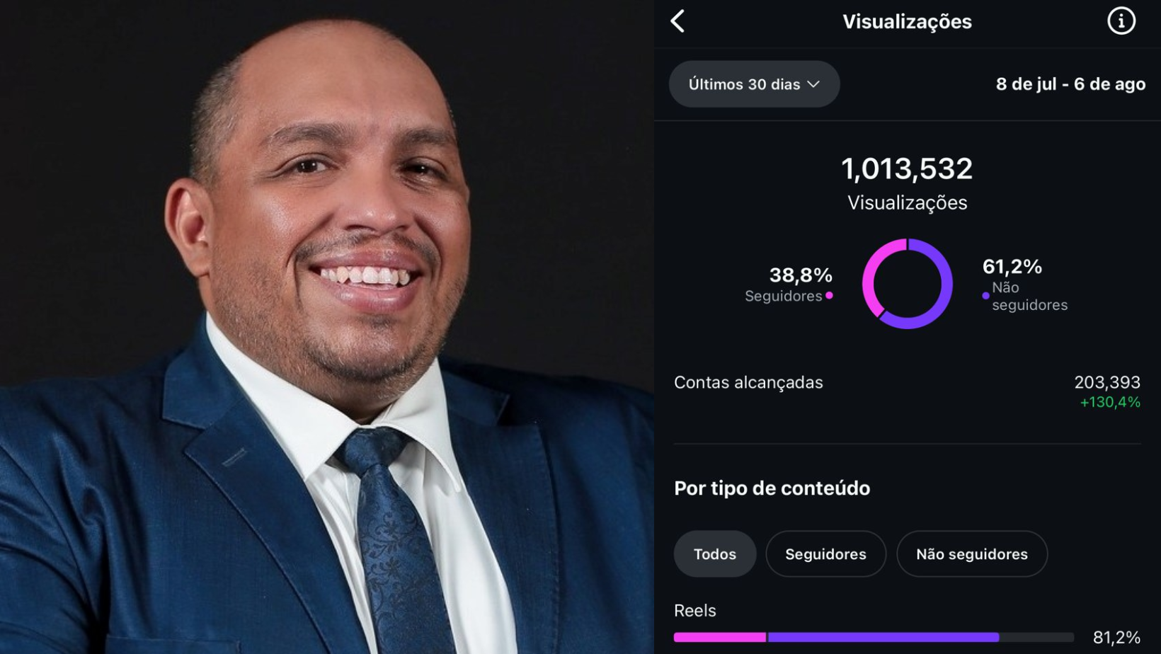 1 milhão de visualizações