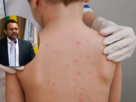 meningite suspeita Redenção Pará